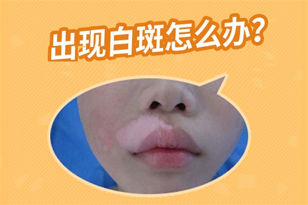 銅陵白癜風的病發因素有哪